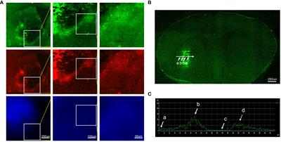 Blocking autofluorescence in brain tissues affected by ischemic stroke, hemorrhagic stroke, or traumatic brain injury